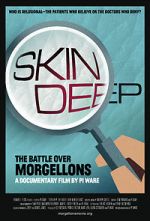 Watch Skin Deep: The Battle Over Morgellons 2KMovies