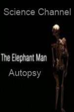Watch Science Channel Elephant Man Autopsy 2KMovies