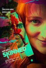 Watch Skinned 2KMovies