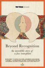 Watch Beyond Recognition: The Incredible Story of a Face Transplant 2KMovies