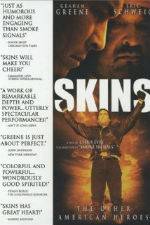 Watch Skins 2KMovies