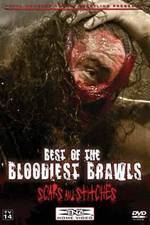 Watch TNA Wrestling: Best of the Bloodiest Brawls - Scars and Stitches 2KMovies