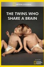 Watch National Geographic The Twins Who Share A Brain 2KMovies