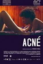 Watch Acné 2KMovies