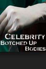 Watch Celebrity Botched Up Bodies 2KMovies